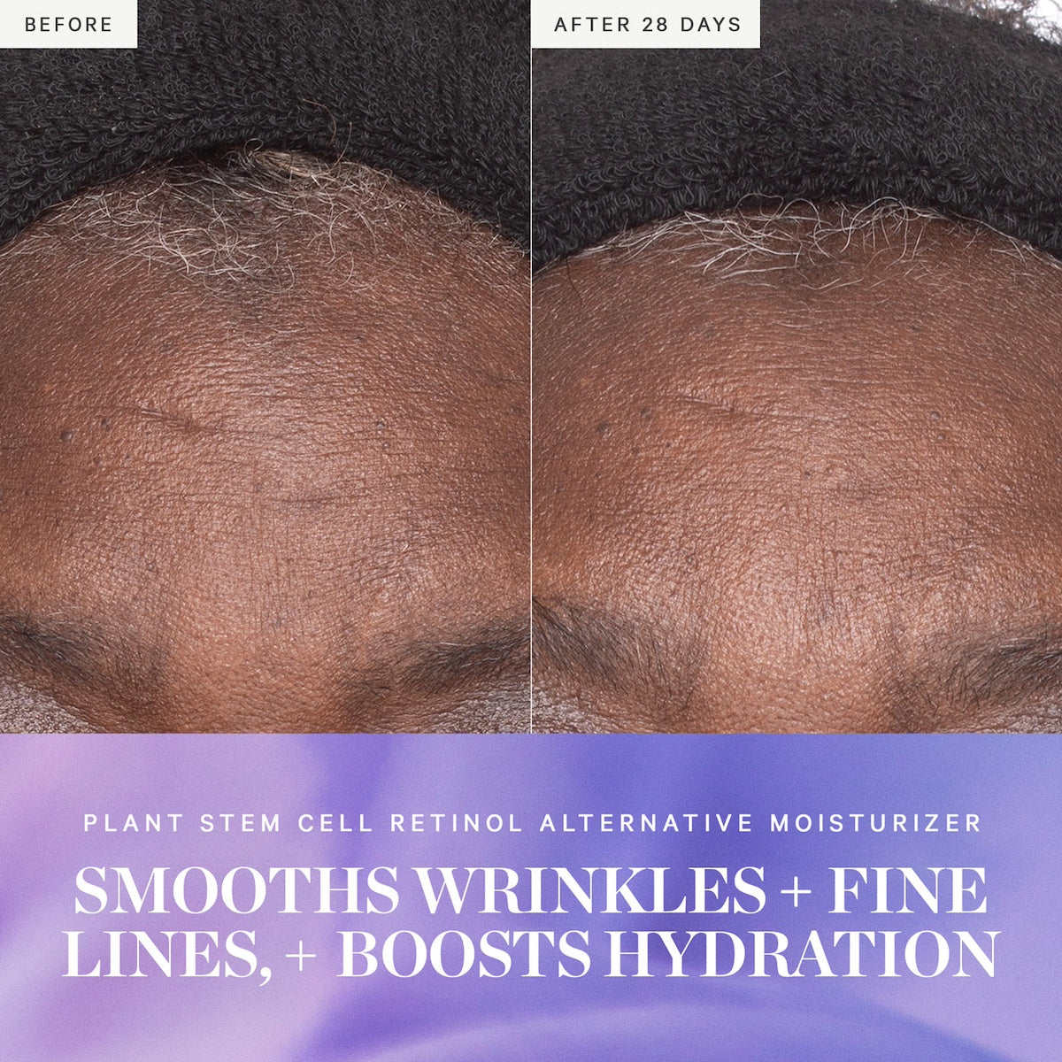 Buy Bakuchiol Moisturizer | Plant Stem Cell Moisturizer